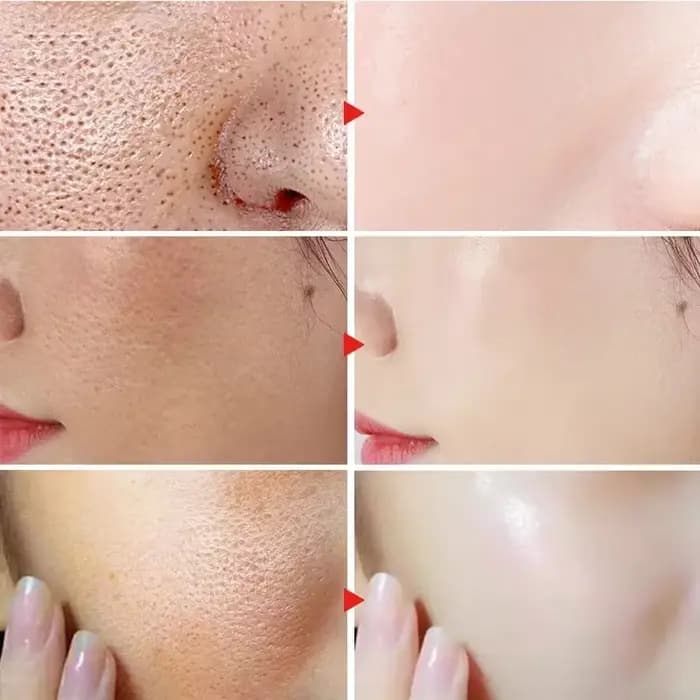 Sérum réparateur de rougeurs du visage