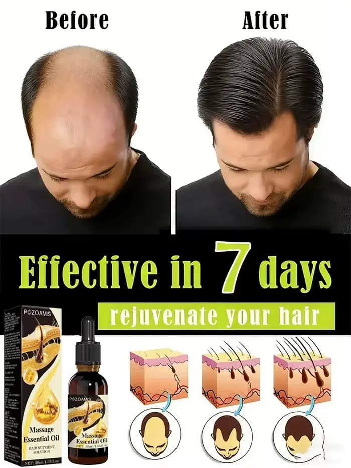 Nourrit les racines des cheveux, répare les dommages à la racine et fait apparaître des cheveux plus épais