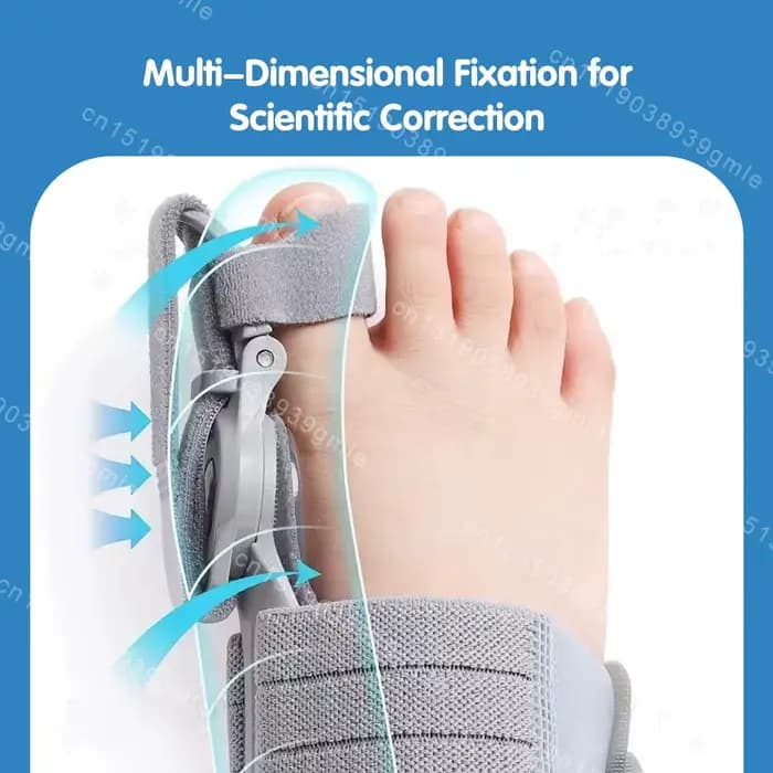 Correcteur d'oignon réglable Hallux Valgu correcteur de gros orteil Valgus correcteur d'orteil rotatif lisseur Correction d'orteil réglable
