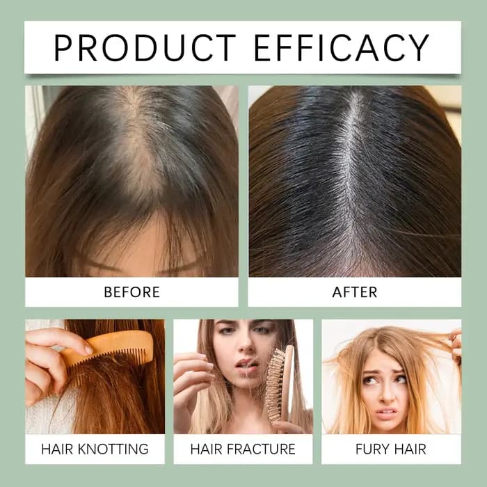 Shampoo à l'Ortie Traitement Fortifiant Volumisant Léger Nourrissant en Profondeur Nettoyage du Cuir Chevelu Doux Cheveux Gras pour Tous Types