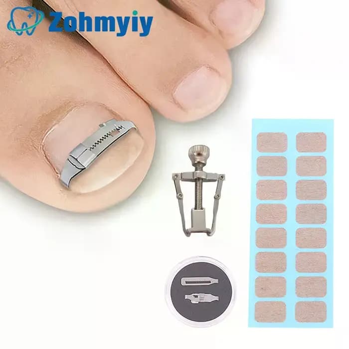 Outils de Correction des Ongles Incarnés, Traitement Professionnel de la Pédicure, Soin des Pieds, Outil de Correction des Ongles Incarnés