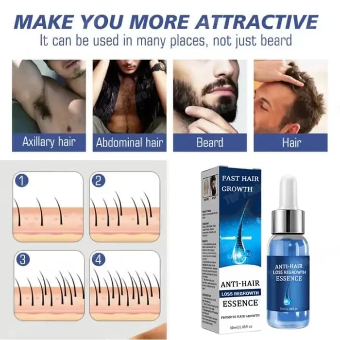 Huile essentielle pour les soins des cheveux, adaptée aux personnes aux cheveux fins et doux.