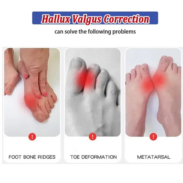 Correcteur d'hallux Valgus à microcourant Ems réglable, soins des pieds, séparateurs d'orteils, réparation de Ligament, Correction du pouce