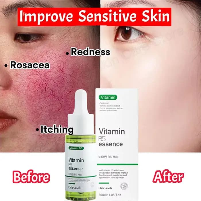 Sérum Réparateur Anti-Rougeurs Visage – Améliore la Peau Sensible et la Sécheresse – Hydratant Apaisant – Élimine la Rosacée – Cosmétiques Coréens