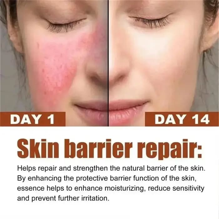 Crème réparatrice pour les rougeurs du visage
