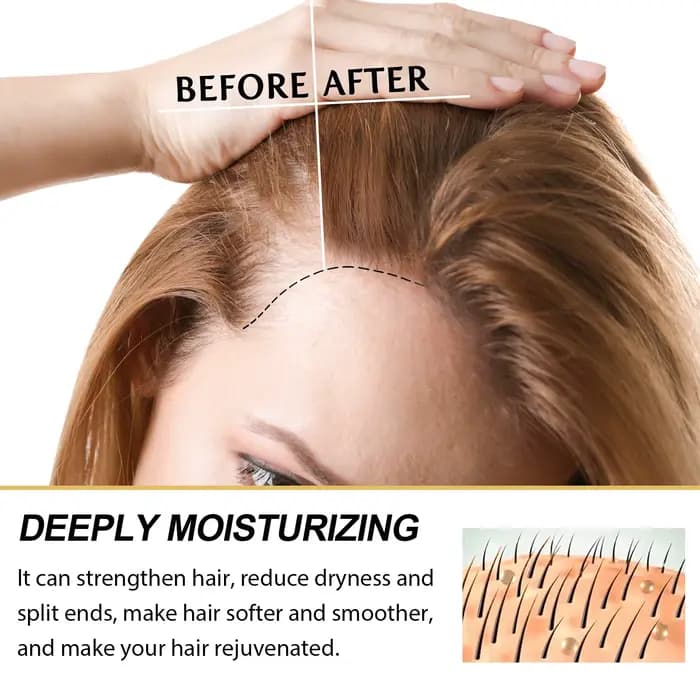Soins capillaires, huiles essentielles originales et authentiques, liquide pour perte de cheveux, soins de santé, beauté, cheveux denses, sérum amélioré, 100%