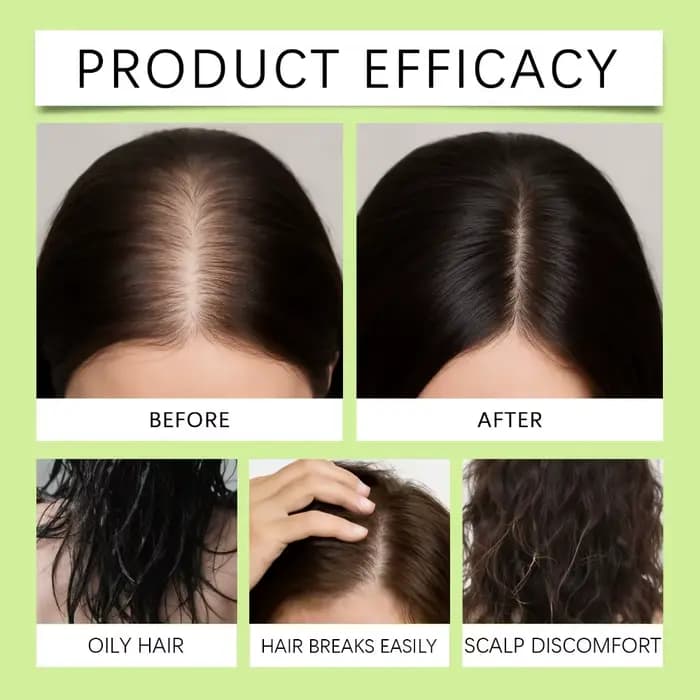 Sérum capillaire doux qui nourrit le cuir chevelu et s'occupe de l'adoucissement des cheveux, soin quotidien du cuir chevelu