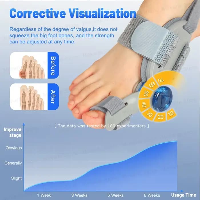 Correcteur d'hallux valgus réglable pour le gros orteil, pour le pied gauche et droit, orthopédique, soin des pieds