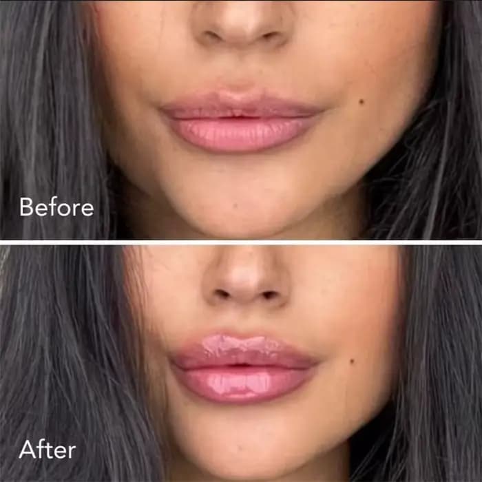 Brillant tulipe lèvres plus dodues épicule repulpant Lip Shot extrême