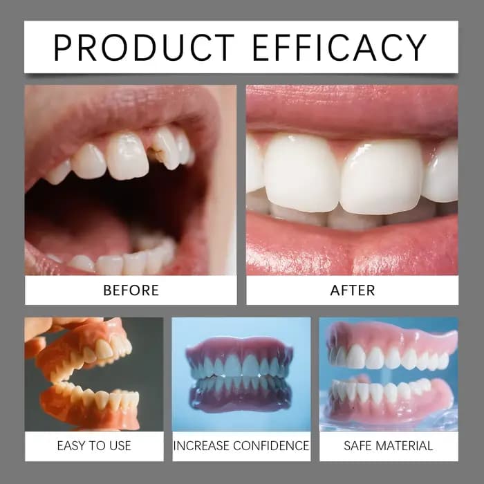 Kit de décoration de prothèses dentaires : met en valeur la beauté du sourire, ajustement naturel, matériau confortable, prothèses pratiques, soins dentaires