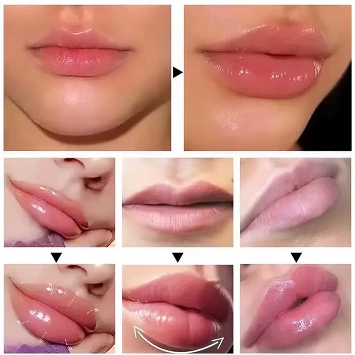 Huile Essentielle Repulpante Instantanée pour les Lèvres – Augmente l'Élasticité