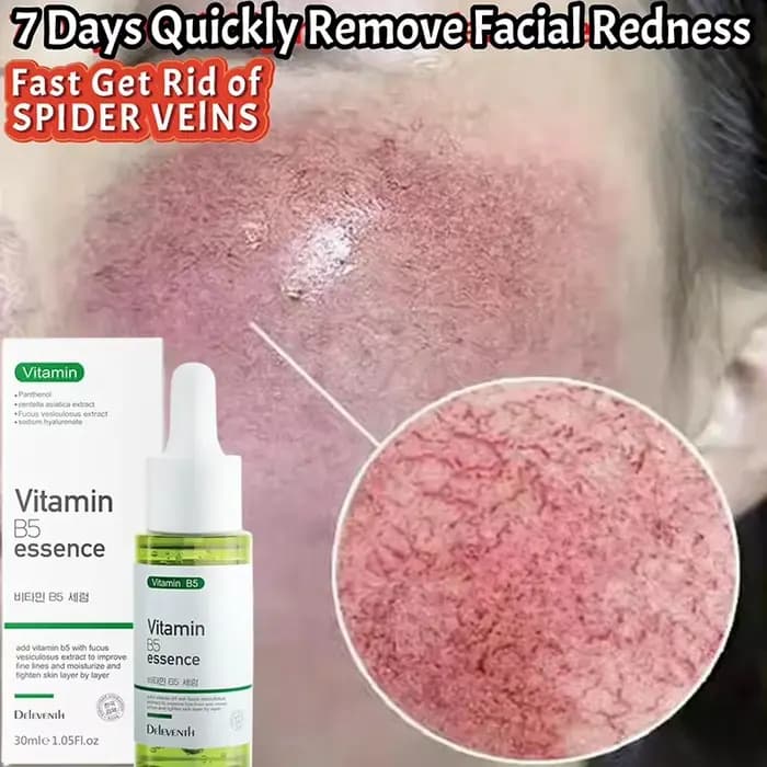Sérum Réparateur Anti-Rougeurs Visage – Améliore la Peau Sensible et la Sécheresse – Hydratant Apaisant – Élimine la Rosacée – Cosmétiques Coréens
